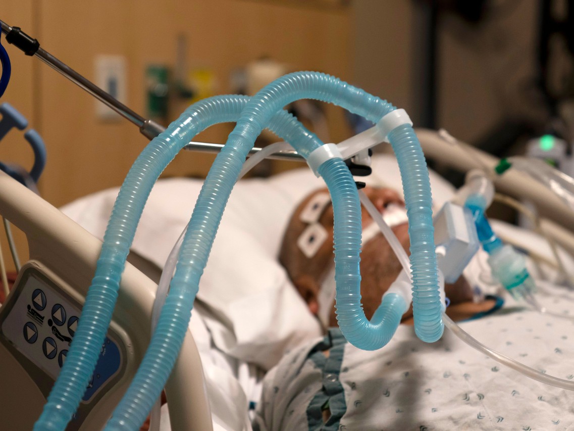 In this Nov. 19, 2020 file photo Ventilator tubes are attached a COVID-19 patient at Providence Holy Cross Medical Center in the Mission Hills section of Los Angeles.