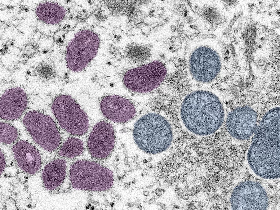 An electron microscopic image of mpox virus particles.