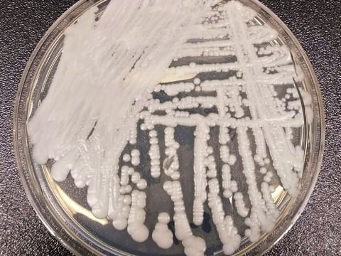This undated photo made available by the Centers for Disease Control and Prevention shows a strain of Candida auris cultured in a petri dish at a CDC laboratory.