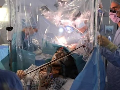 Dagmar Turner recently played her violin during brain surgery in London. "The violin is my passion," she said in a statement. "I've been playing since I was 10 years old."