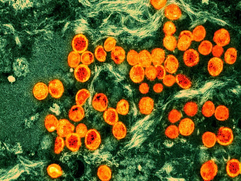 Monkeypox is getting a new name: mpox. Here, monkeypox virus particles (orange) are seen within an infected cell (green), after being cultured in a laboratory. The image was produced by a colorized transmission electron micrograph.