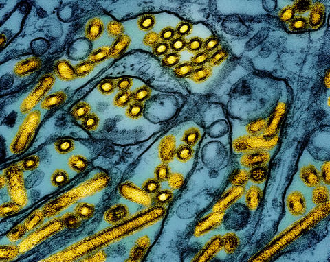 This colorized electron microscope image released by the National Institute of Allergy and Infectious Diseases in March shows avian influenza A H5N1 virus particles (in yellow).