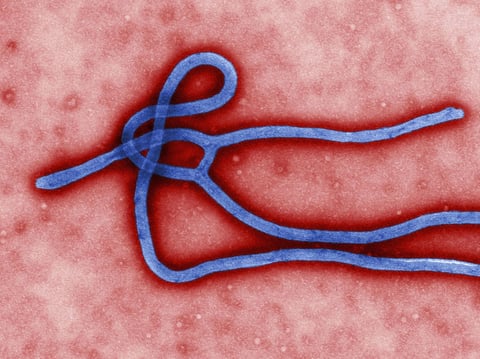 Ebola virus virion. Created by CDC microbiologist Cynthia Goldsmith, this colorized transmission electron micrograph (TEM) revealed some of the ultrastructural morphology displayed by an Ebola virus virion. /Wikimedia Commons