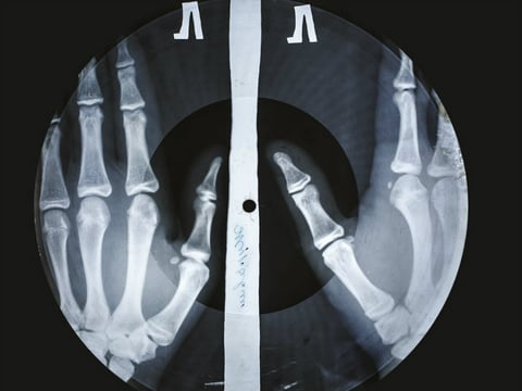 X-Ray Audio: The Strange Story of Soviet Music on the Bone explores a curious bootlegging practice that arose in Cold War Russia.