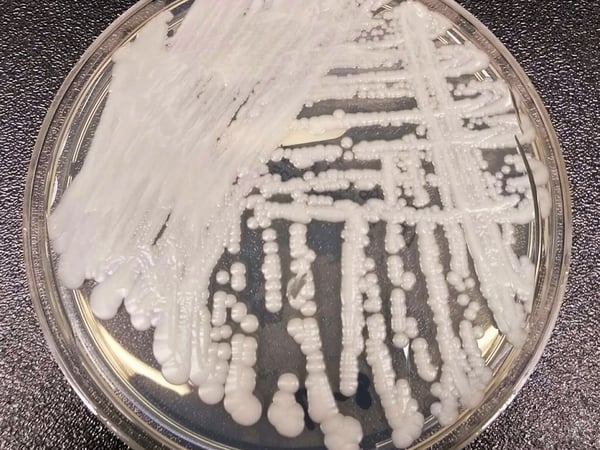 This undated photo made available by the Centers for Disease Control and Prevention shows a strain of Candida auris cultured in a petri dish at a CDC laboratory.