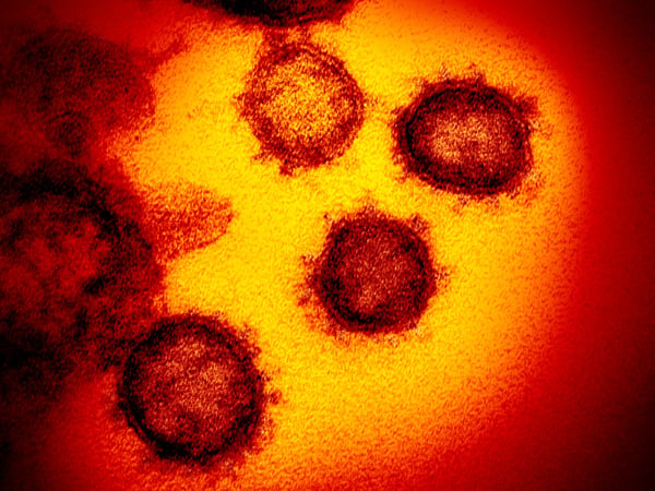 This undated electron microscope image made available by the U.S. National Institutes of Health in February 2020 shows the Novel Coronavirus SARS-CoV-2.