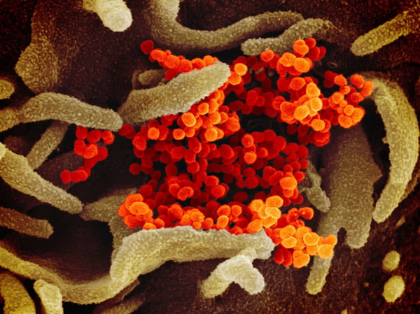 This scanning electron microscope image shows SARS-CoV-2 (orange)—also known as 2019-nCoV, the virus that causes COVID-19—isolated from a patient in the U.S., emerging from the surface of cells (green) cultured in the lab.