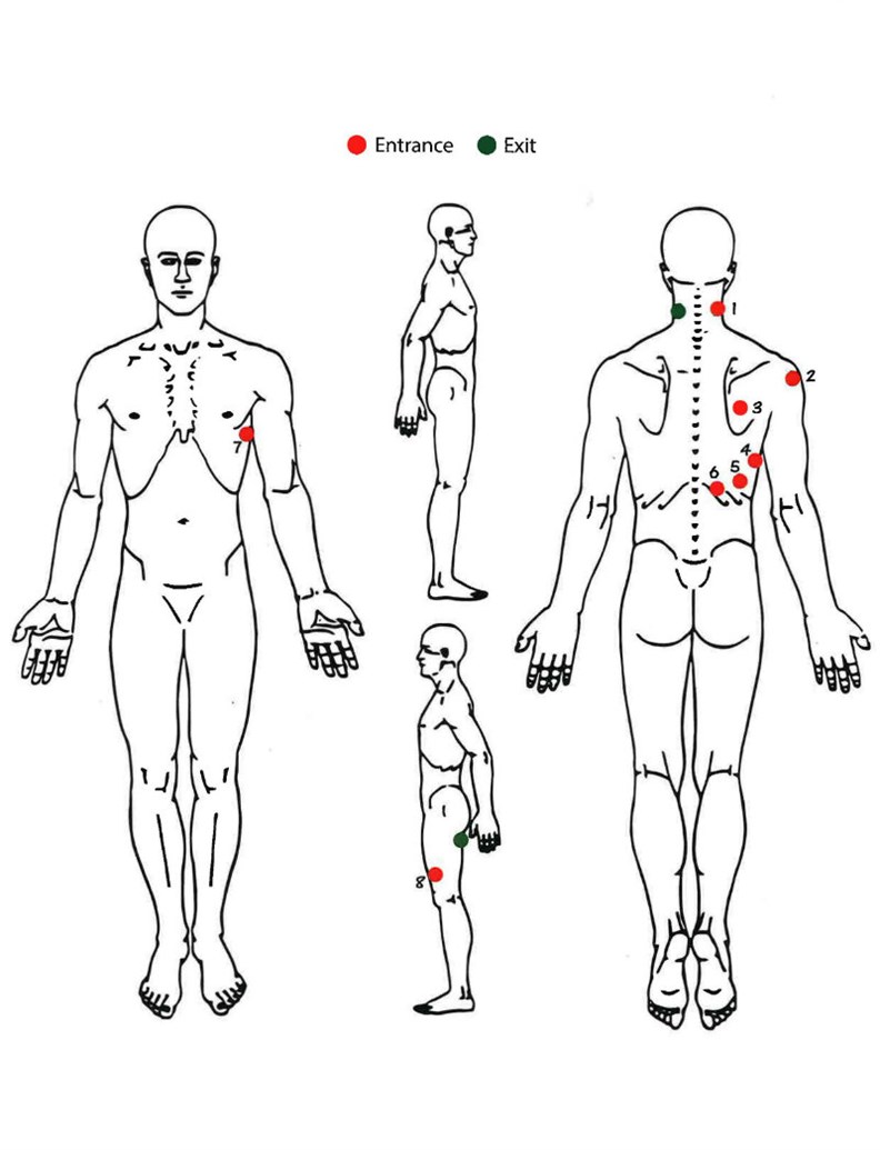 Diagram Of Stephon Clark Gunshot Wounds Provided By Dr
