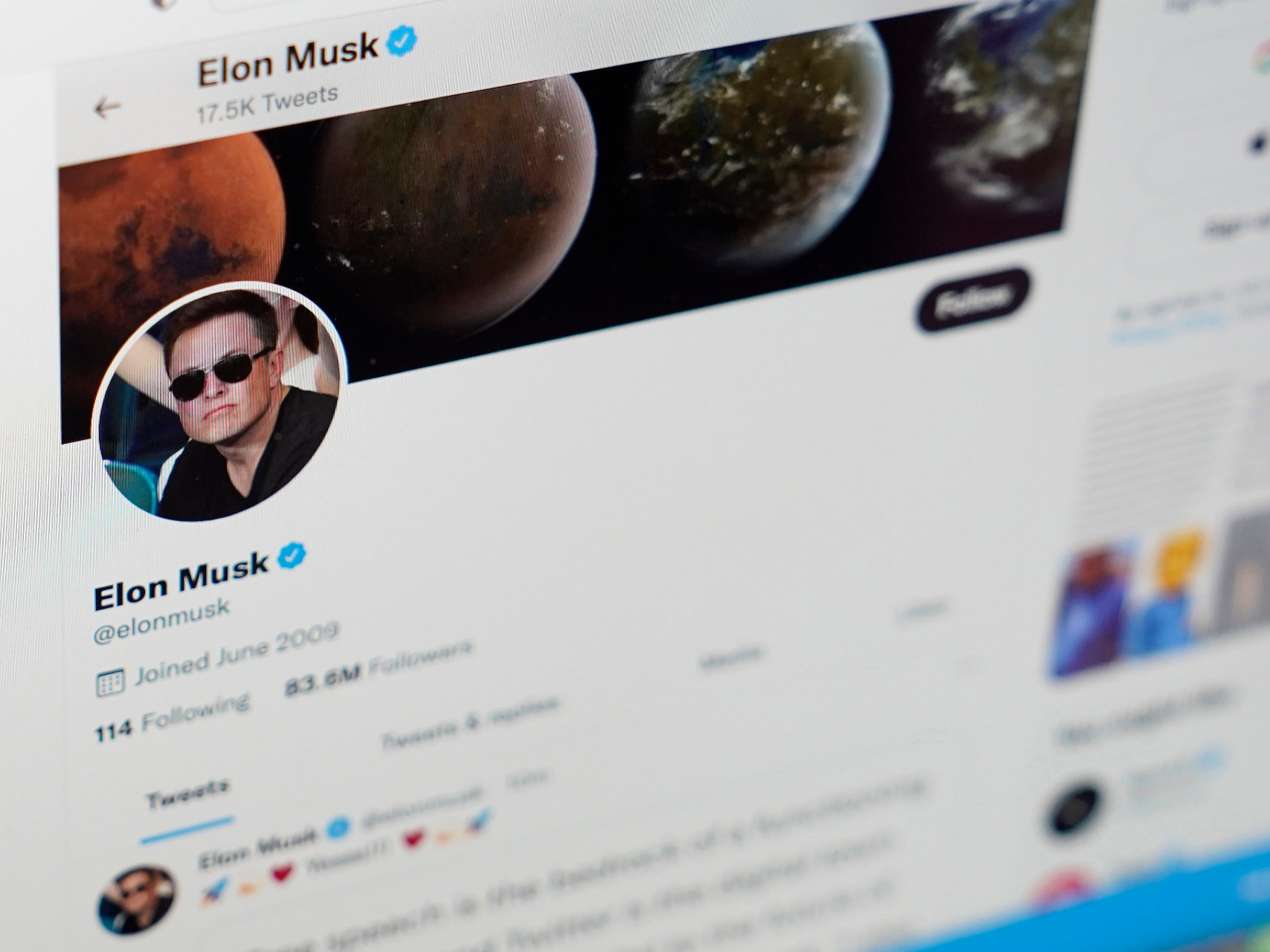 Elon Musk Plastic Surgery: The Unveiling of the Astonishing Transformation