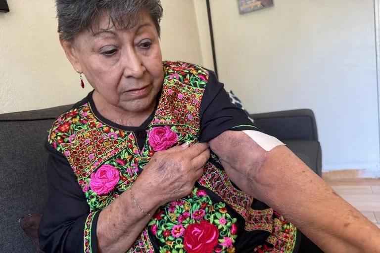 Through Medi-Cal, Rodriguez has received help managing medical appointments after arm surgery. State officials say social healthcare provides a more cost-effective approach for people with complex health conditions.